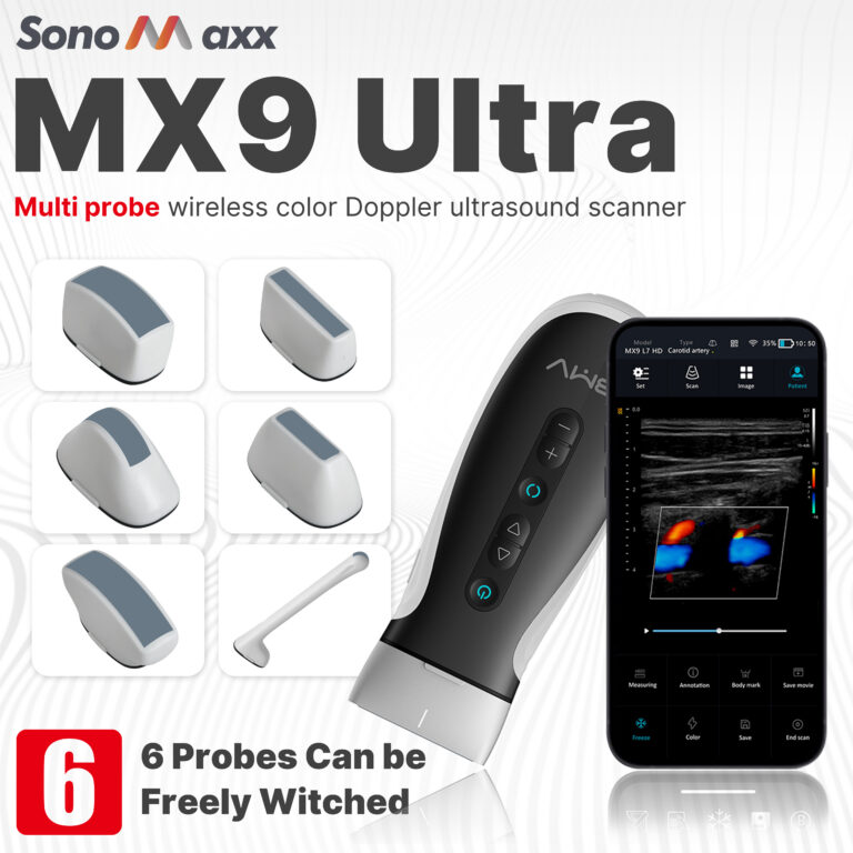 MX9u